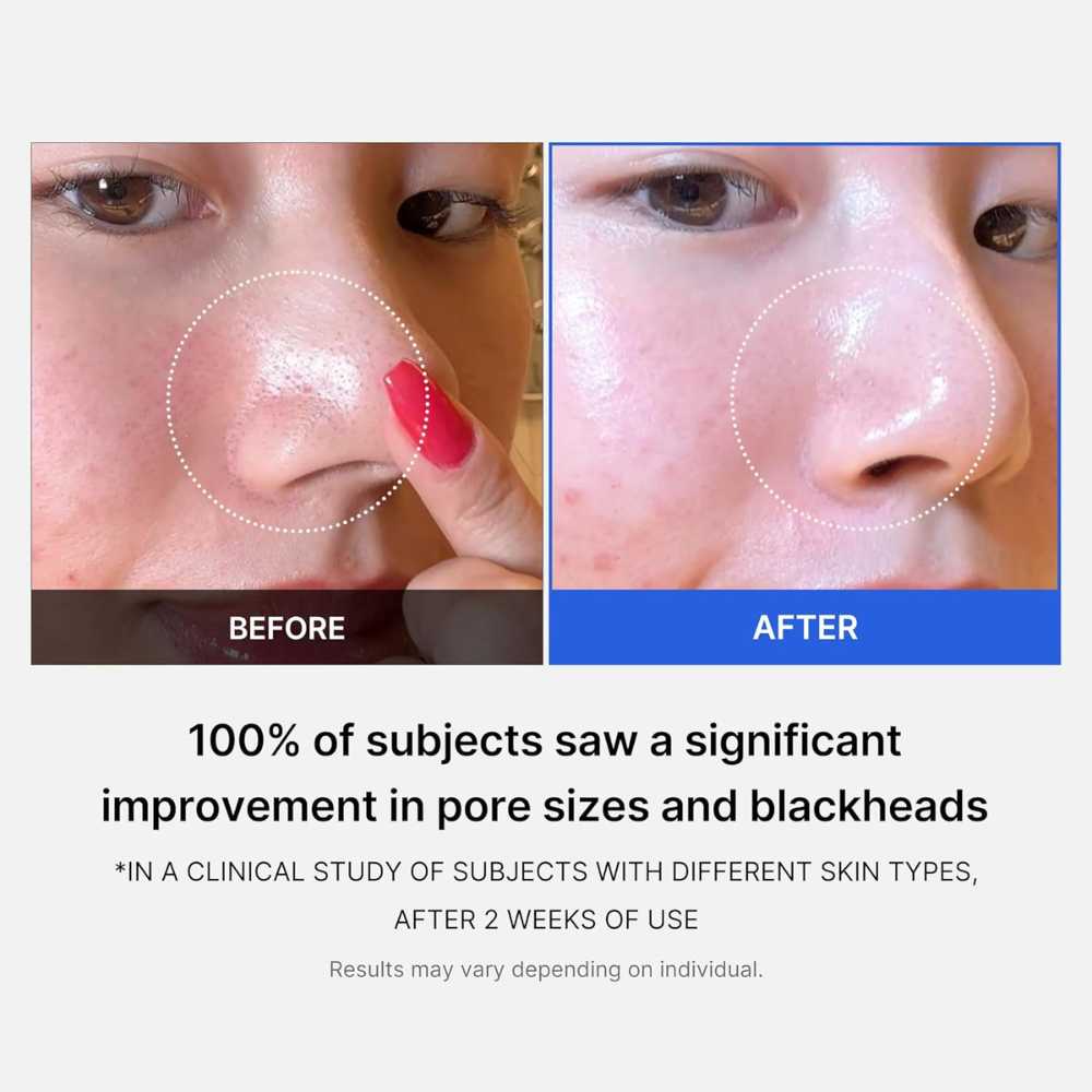 Medicube Zero Pore Pad, 70 pads